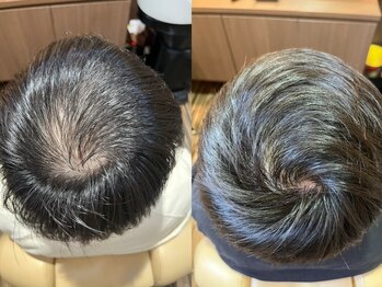 エルアスクの写真/【縮毛矯正×エイジング専門店】髪質を見極めながらのメニュー提案や施術で気になるお悩みをしっかり改善◎