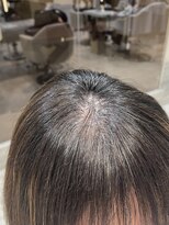 ケンジ 平塚 アネッタ(KENJE annetta)&nbsp;顔周り縮毛【ポイント縮毛矯正】
