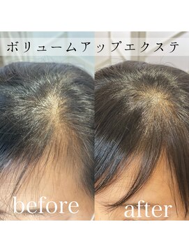 ツムグ 代官山店(TUMUGU) おとな女性の髪悩み解消【ボリュームアップエクステ】前髪