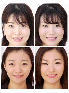 アガール 黄金比メイクレッスン　ビフォーアフター