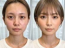ハーツオオサカ(HE:ARTS OSAKA)の雰囲気（加工アプリを卒業する。現実の鏡が、一番好きな自分に変わる。）