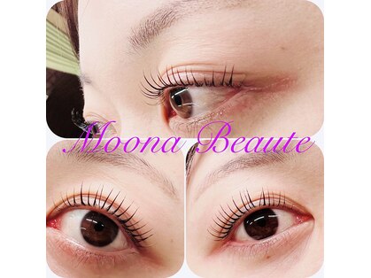 ムーナボーテ(Moona Beaute)の写真