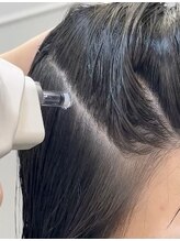 ルーツ バイ リズム(root by r-ism)&nbsp;高圧ジェットで頭皮深層にアプローチ◎ヒト幹細胞