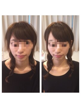 アドール(ADOR) 韓国式小顔コルギ