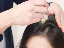 専用スコープによる頭皮環境チェック