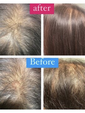 ユーリカ リチェルコ 四天王寺前夕陽ケ丘店 本格育毛促進