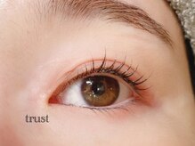 トラスト(TRuST)