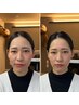 骨格補正スパ(頭、首、顔)+カット　￥14850