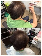 ナルヘアー