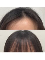 ミユーズ 表参道(Miyu's) ペタっとしない前髪縮毛矯正