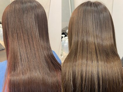 オプティマヘアー(Optima Hair)の写真