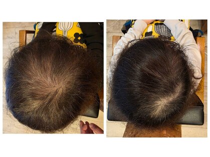 ラウンジアンドヘアープラスグランツ(lounge&hair+grants)の写真