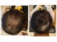 ラウンジアンドヘアープラスグランツ(lounge&hair+grants)の写真