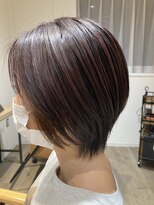 カミーノプラス(Camino+)&nbsp;ソフト矯正のビフォー＆アフター