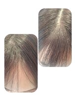 ユーフォルムギンザ(y-Forme Ginza)&nbsp;話題のトキカタ♪前髪編