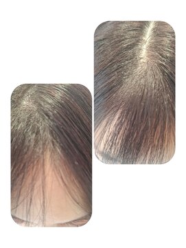 ユーフォルムギンザ(y-Forme Ginza) 話題のトキカタ♪前髪編