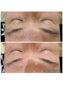 マユシェービング