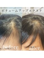 ツムグ 代官山店(TUMUGU)&nbsp;おとな女性の髪悩み解消【ボリュームアップエクステ】前髪