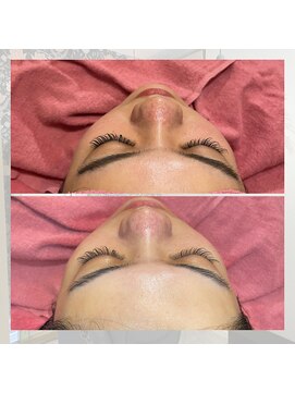 ヘアメイクエコー hair make echo レディースシェービング