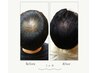 メンズ限定★カット+スパ＋100％濃度ヒト幹細胞＋+眉カット￥22550→￥19800
