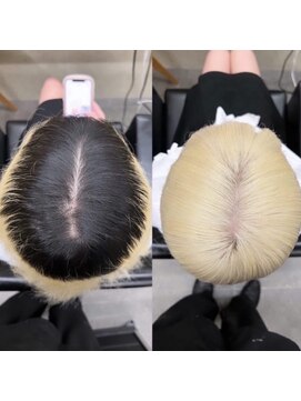 モニカ 原宿店(MONIQA) ホワイトカラー