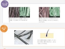 【スコープ診断】