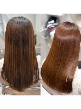 メルス(MeLS) Before→After  19