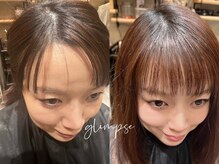 【魔法のハサミ・ヘアリセッター】前髪・つむじ・生えグセの悩みに、扱いやすさで応える。