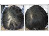 【ヘアサイクル整え育毛スパ】×【ヒト幹細胞培養液110%】41,800円→33,440円
