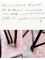 グロウズ(GROW’S) ヘッドスパ/オージュア/岡山