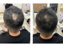 ミライ メン(MIRAI MEN)の雰囲気（HSC強髪プログラムは諦めた方も成果が出ています。ご相談下さい）