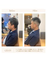 グランバイ アトリエドングリ(Grand × AtlierDonguri)&nbsp;お客様髪質改善データ1941（メンズカット）