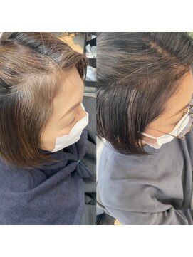 ティダスマイル ふじみ野店(tida smile) 脱白髪染めハイライトbefore_After
