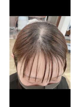 アローズ(arose) 3D増毛で前髪を