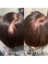 ツムグ 代官山店(TUMUGU)&nbsp;【地肌見え】おとな女性悩み解消ボリュームアップエクステ代官山