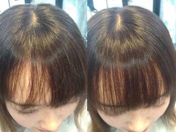 クライマックス(CLIMAX)の写真/じっくりとカウンセリングを行い、髪のお悩みを解決☆髪質や生え癖を見極め、あなたに合った施術をご提案♪