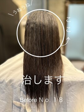 ヒライ(HIRAI) No.18 30代「写真がきらい」Before