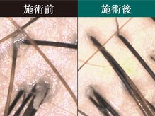 髪も頭皮も贅沢にケア♪