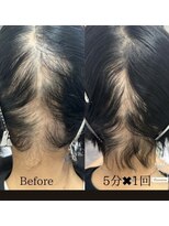 髪質改善 ソアリス 烏丸丸太町店(soiris)&nbsp;髪育トリートメント(細毛改善)