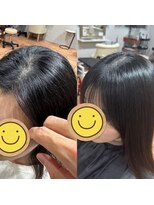 ボクノ 3号店(bokuno) 前髪の割れ 解消