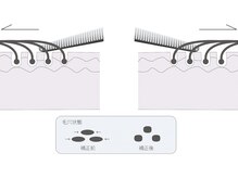 毛根補正効果（詳しくは勅使河原まで！）