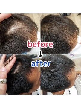ルーミールーム(RoomieRoom) お悩み解決☆頭皮改善!メンズ育毛促進ケア