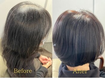 アクロ ヘアー(ACRO HAIR)の写真/この先の髪も、最良の状態を保つために…。エイジングケア特化サロン★お客様の状態に合わせてご提案♪