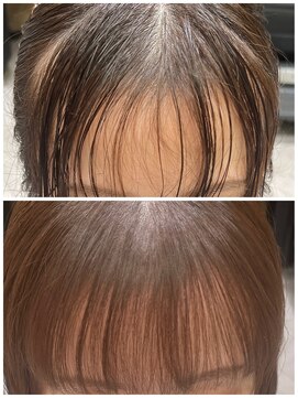 ゼスト フィーノ(ZEST fino) 【平林鼓】前髪クロスパーマでお悩みの浮きや割れ改善!