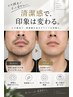 メンズ髭 脱 毛 4400→2200