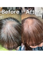 ツムグ 代官山 中目黒(TUMUGU)&nbsp;前髪割れ・地肌見え解消/ボリュームアップエクステ