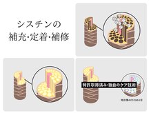 point 3 ◇ バイカルテ特許技術［Cip SHOT］ってどんな技術？