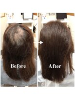 アンフィーロ(An filo)&nbsp;ヘアループ、増毛エクステ