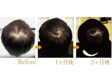 【こだわり１５】細くなった毛髪は、また元に戻るって本当？はいっ本当です。女性も男性もご来店されてます