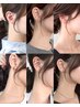 【うなじ脱　毛】カット＋ネープケア